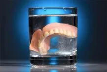 Основни зъбни импланти алтернативни характеристики, предимства и недостатъци