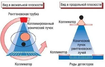 Foundations of Computer tomográfia