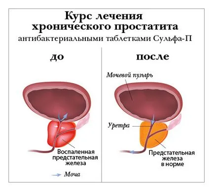 Панацея е! Как да се лекува, за да се възстанови и да живее свободна от болест, лекува рак, диабет, простатит