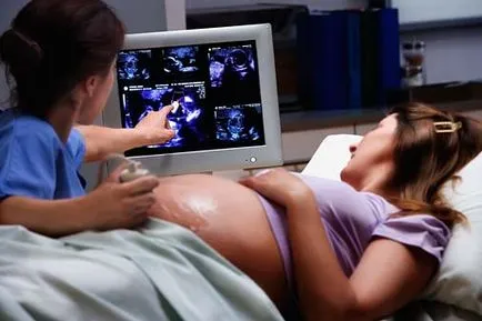 Първият ултразвук по време на бременност
