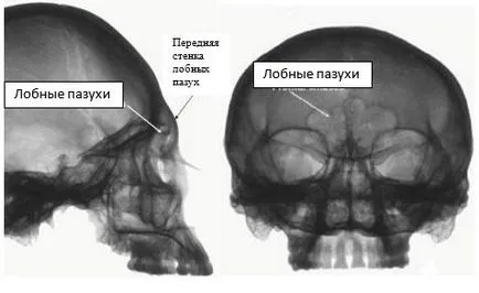 műanyag homlok