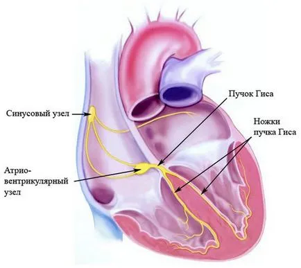 Teljes szív-blokk típusú, okok, tünetek, kezelés