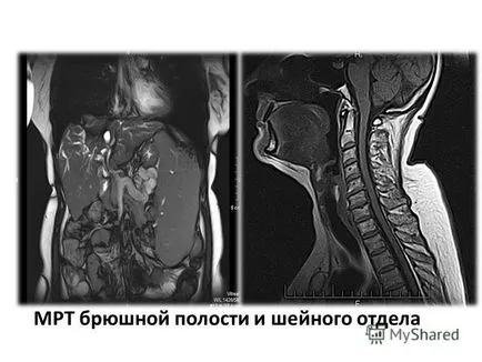 bemutatása radiodiagnosztikában