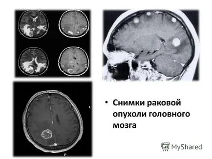 bemutatása radiodiagnosztikában