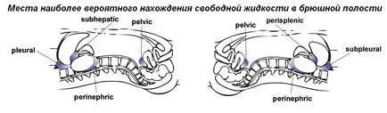 Регионални анестезия по ултразвук - аварийно ултразвук в травма (бързо)