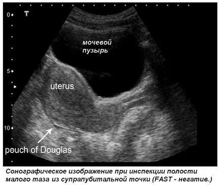 Regionális anesztézia alatt ultrahang - sürgősségi ultrahang trauma (gyors)