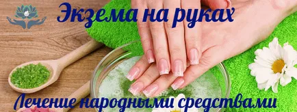 Най-ефективните народни средства за екзема на ръцете и краката