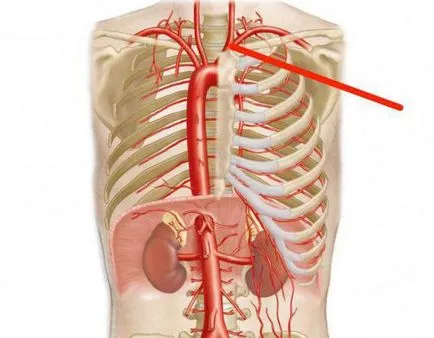 Brachiocephalic концепция багажника и дефиниция