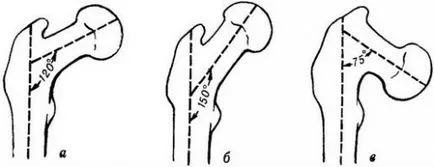 șold Anatomia omului comun (structura) și funcția, patologie