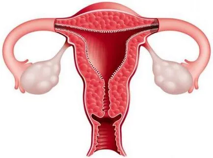 A vastagság a endometrium azáltal napos ciklus norma és eltérés