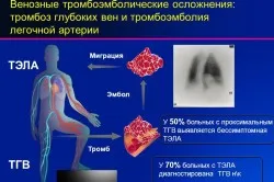 Tromboza, simptome pulmonare si tratament