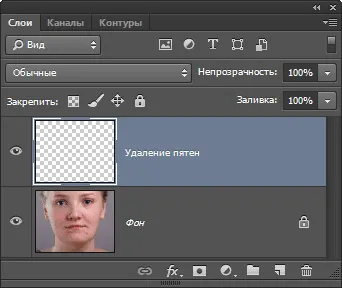 Eltávolítása az akne, pattanások és mitesszerek az arcot photoshop