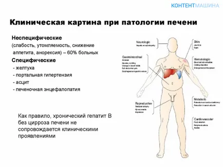 Simptomele bolii hepatice si tratamentul bolii