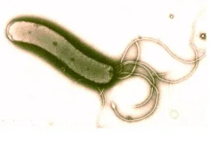 Тази коварна бактерия Helicobacter Pylori