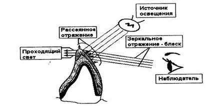 Proprietățile estetice ale materialelor de restaurare dentară - studopediya