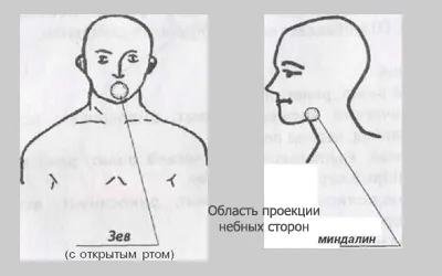 лечение на хроничен тонзилит Bioptron