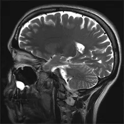 MRI диагностичен център в Kupchino