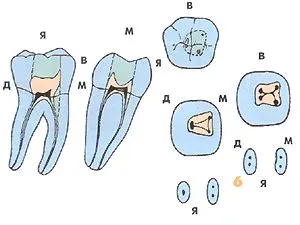 Endodontic szempontból a morfológia az alsó maradandó fogak - Medical Encyclopedia