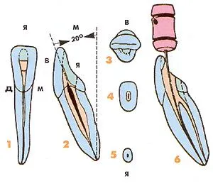 Endodontic szempontból a morfológia az alsó maradandó fogak - Medical Encyclopedia