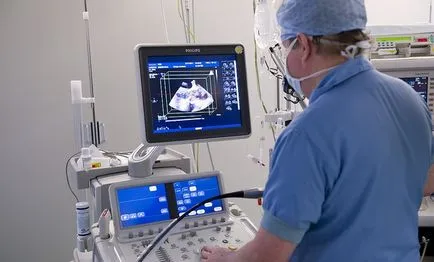 kg Echo infarct miocardic - tratament de inima