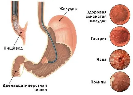 EGD - как да се диша по време на процедурата