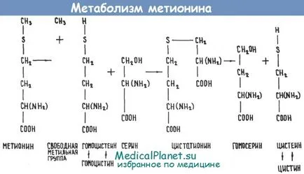 Хомоцистинурията - фенотип диагностика