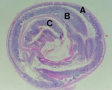 bélelzáródás az USA-ban (előadás diagnostere)