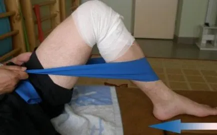Как е постоперативния период след етапи коляното артропластика