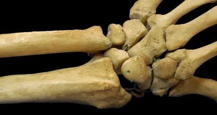Класификация на човешки кости и стави