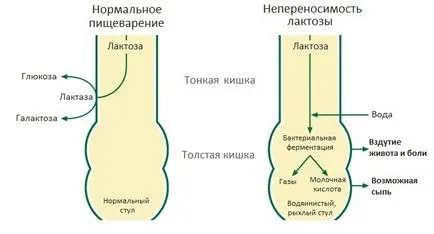 deficit de lactază la sugari cauze, simptome, tratament, diagnostic