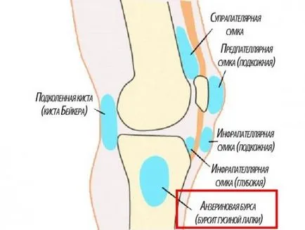 Лечение на бурсит на стъпалото на коляното гъска