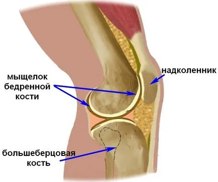 фрактура на коляното кондила и лечение, симптоми