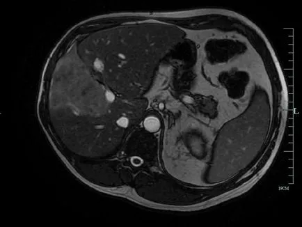 máj MRI Moszkvában az ár, hogy a kontraszt promovistom ára kedvezményes, címét klinikák