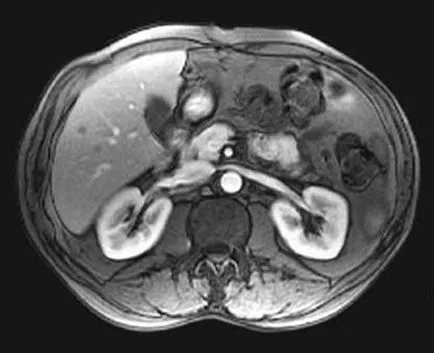 máj MRI Moszkvában az ár, hogy a kontraszt promovistom ára kedvezményes, címét klinikák