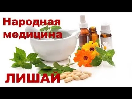 Pityriasis (многоцветни) зостер домашно лечение