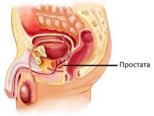 Az első tünetek a prostatitis és a gyulladás a prosztata szöveteit férfiaknál prosztata-gyulladás székrekedés és hasmenés férfiak -