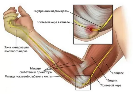 Periartrita cotului comun - tratament simptome de periartrita tratament coturile