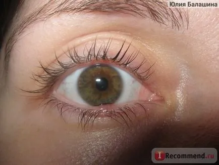 Hormonkezelések: Schering AG diprospan - „chalazion - bővült rend összehasonlítása