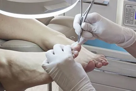 Защо почернели нокти на краката, причини и лечение на ноктите на жените - живеят здравословно