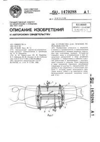 Dispozitivul pentru tratamentul fracturilor membrelor superioare