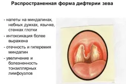 Ваксинирането срещу тетанус и дифтерия