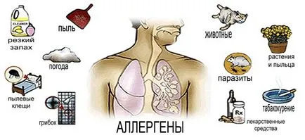 Бронхиалната астма атака