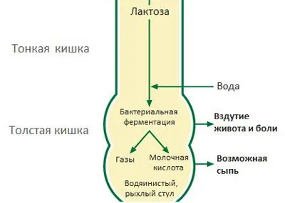 Антиеметични лекарства за деца на различна възраст