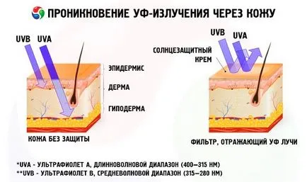 Alunițele după arsurile solare cauze, simptome, diagnostic, tratament, competente pentru sănătate pe iLive -