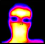 Термични образна диагностика на организма