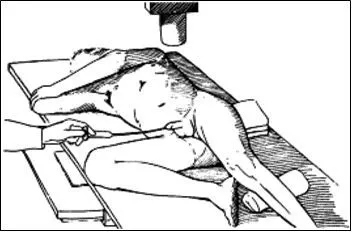 Urethrography férfi (emelkedő és a vizeletürítés)