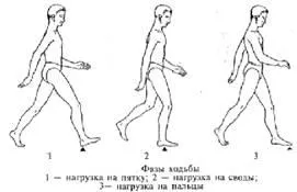 видове плоско стъпало