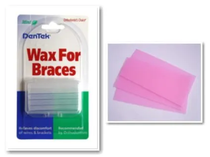 Wax fogszabályozó megoldani a problémát, fekélyek és sebek a szájüregben