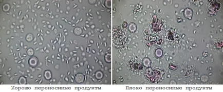 7 коментара към въпроси за теста за непоносимост към храни