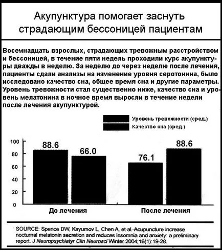 Biohaking сън съвет потвърждава и от науката, забавления портал